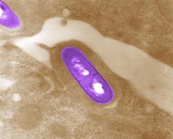 Listeria monocytogenes bacterium under microscope