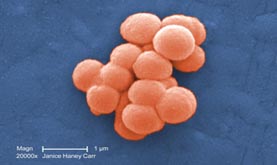 Streptococcal bacteria