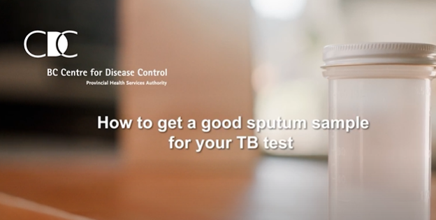 how to get a good sputum sample for your tb test.PNG