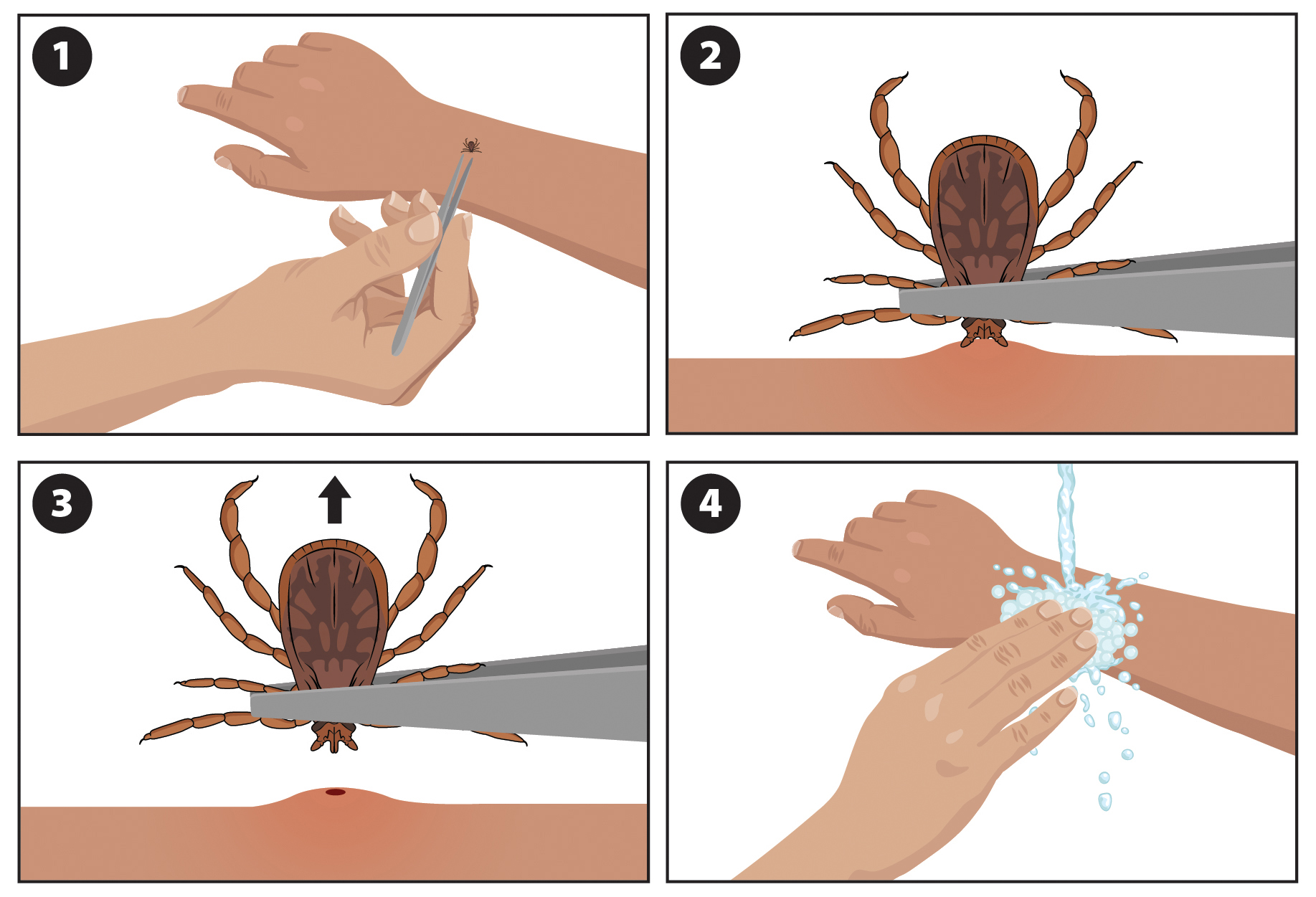 A four step diagram shows how to safely remove a tick with tweezers