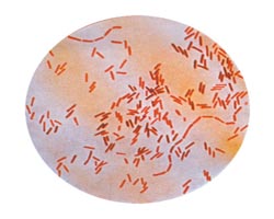 Salmonella Typhi bacteria